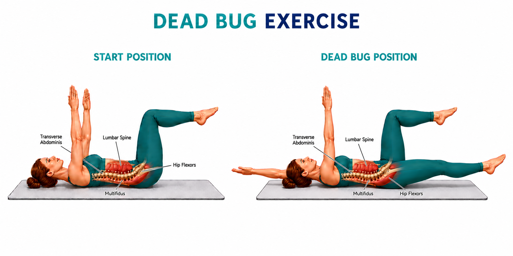 Dead Bug for low back pain — Palmer Chiropractic Kent WA
