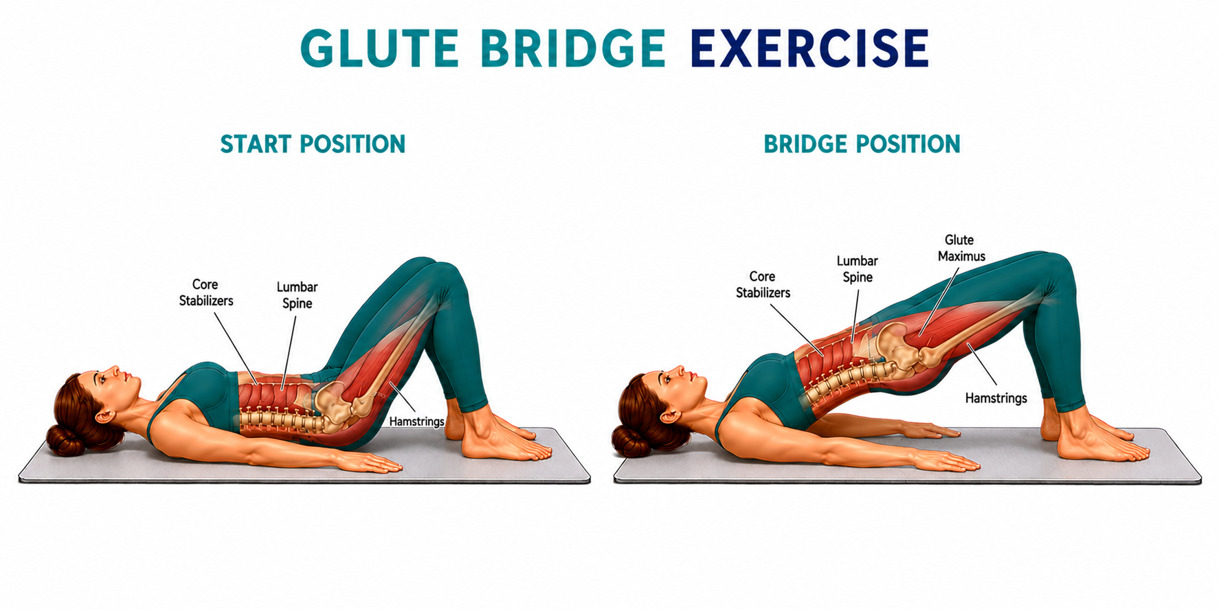 Glute Bridge for low back pain — Palmer Chiropractic Kent WA